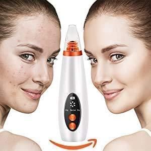 GlowSkin™ Pro Blackhead Remover – Advanced Vacuum Suction Device