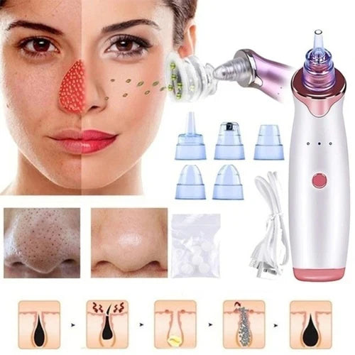 GlowSkin™ Portable Blackhead Remover – Vacuum Suction Device