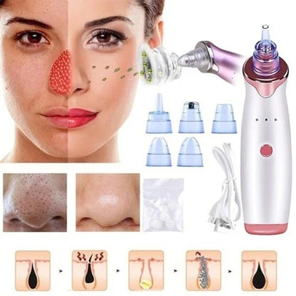 GlowSkin™ Portable Blackhead Remover – Vacuum Suction Device