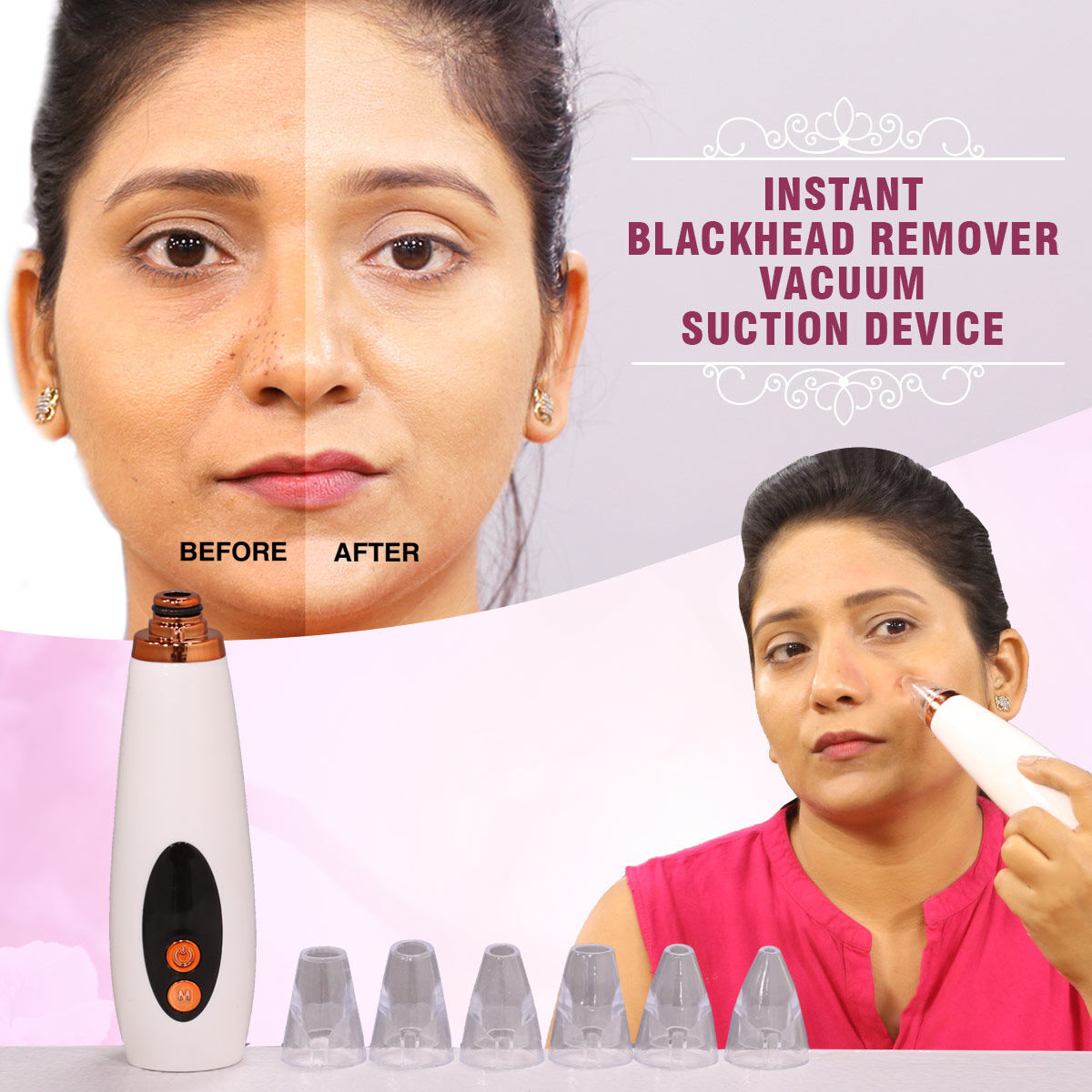 GlowSkin™ Portable Blackhead Remover – Vacuum Suction Device