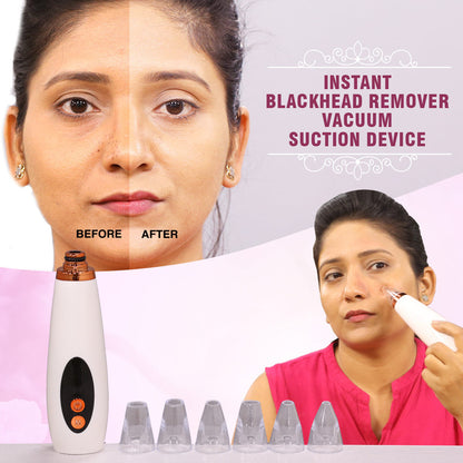 GlowSkin™ Pro Blackhead Remover – Advanced Vacuum Suction Device