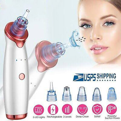 GlowSkin™ Pro Blackhead Remover – Advanced Vacuum Suction Device